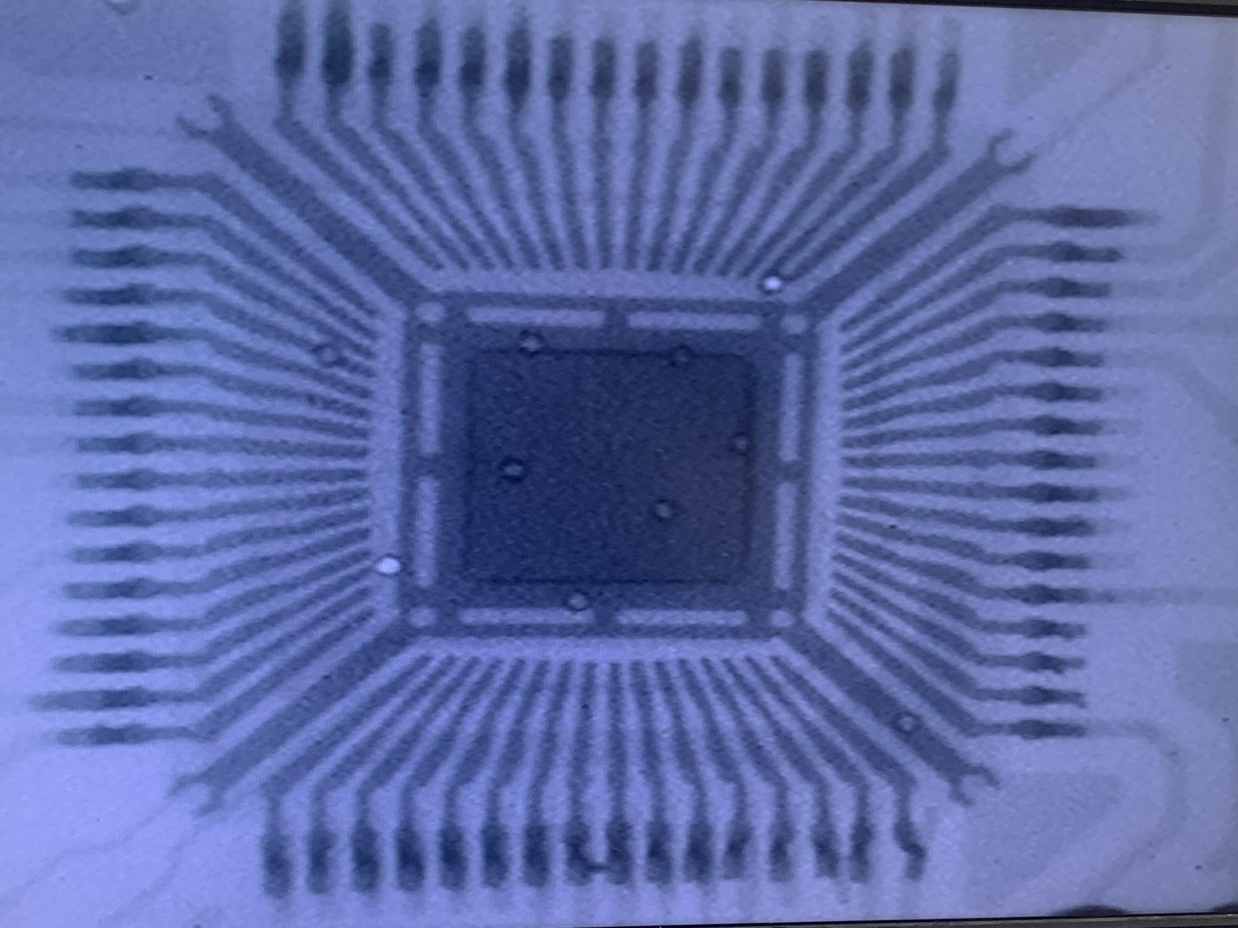 XRAY Zoom